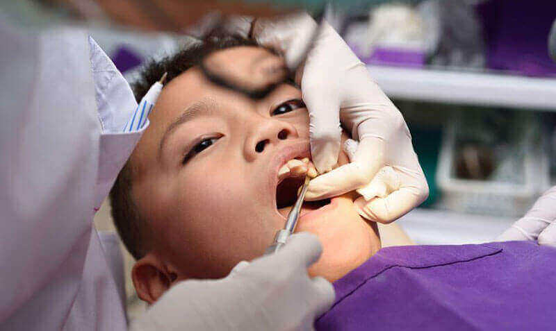 Tooth Extractions Dryden